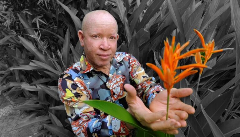 From Taxi Driver to Empowerment: My Journey as an Albinism Advocate