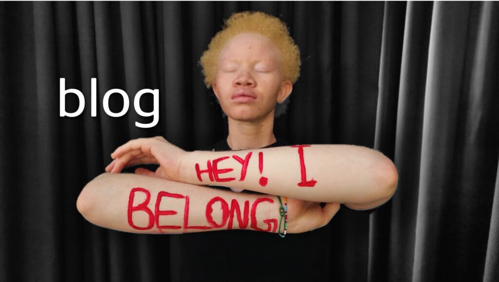 Embracing albinism- image of founder sherleen