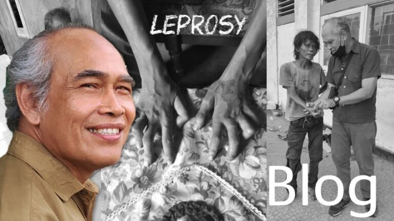 Rising from despair: a doctor's journey from cow fields to leprosy care, and the birth of the house of ketupat